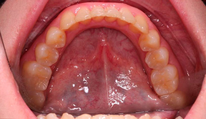 vista interior tras tratamiento de ortodoncia