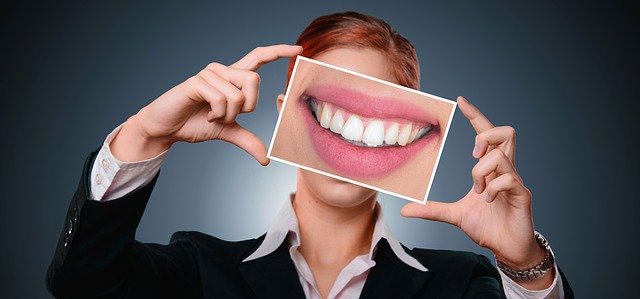 Blanqueamiento dental mitos verdades