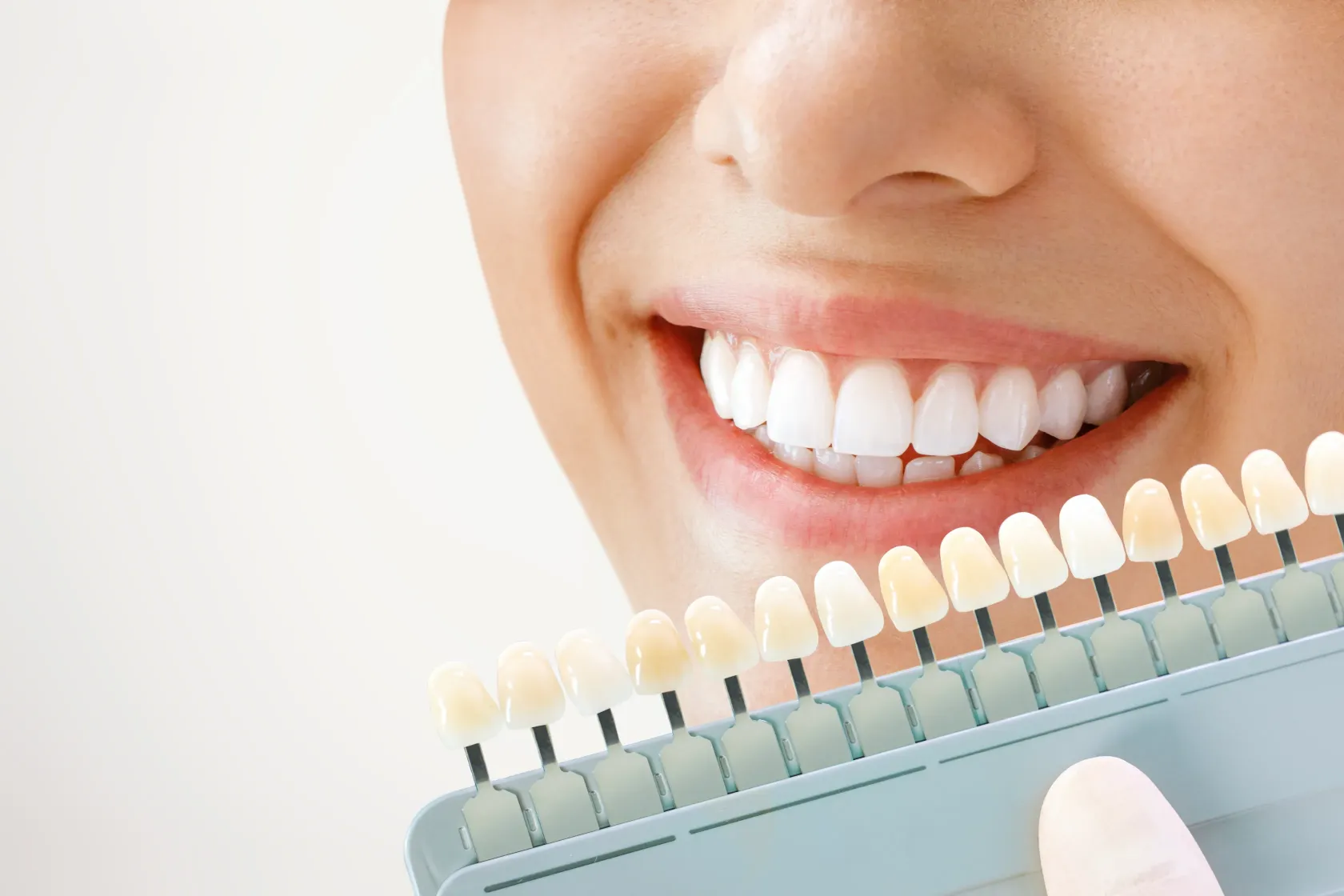 Blanqueamiento dental mitos verdades