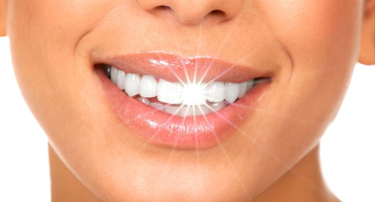 Blanqueamiento dental mitos y verdades