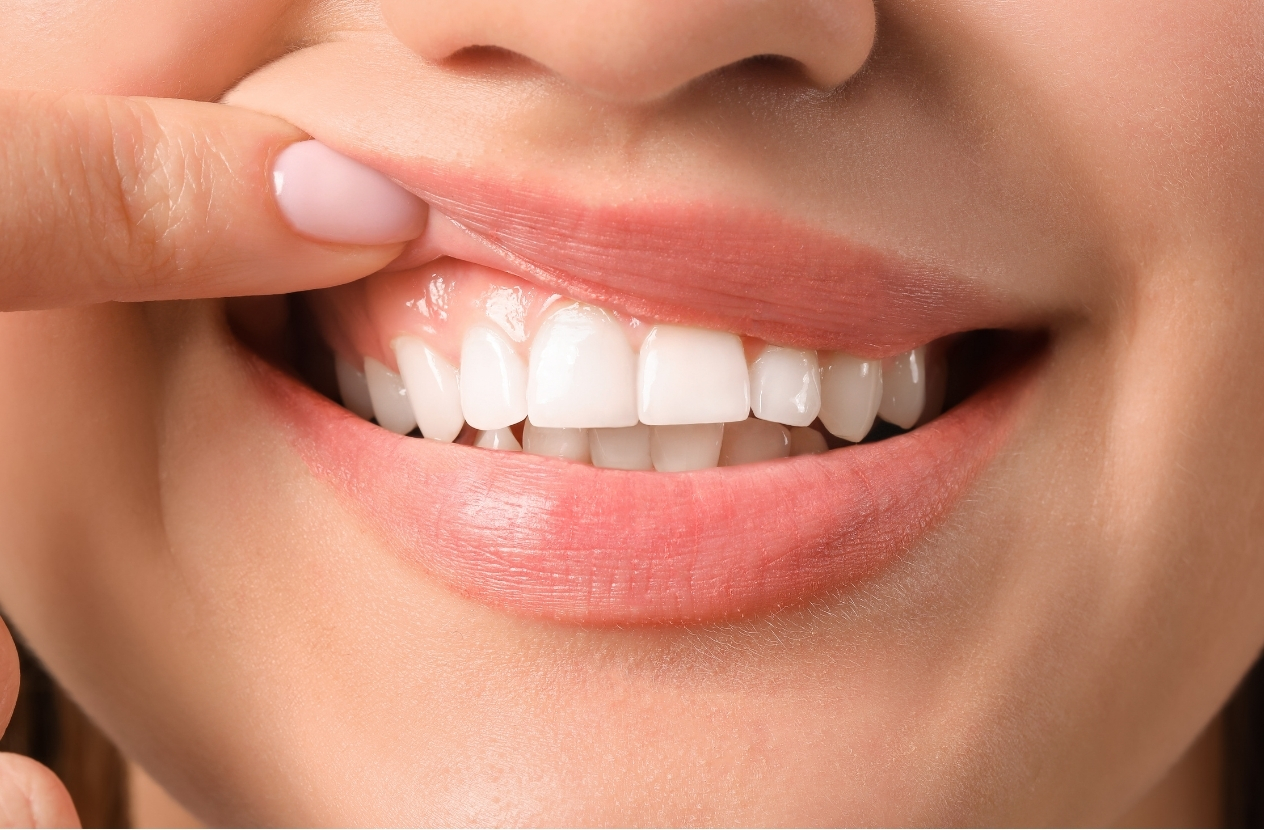 consejos mantener sonrisa blanca