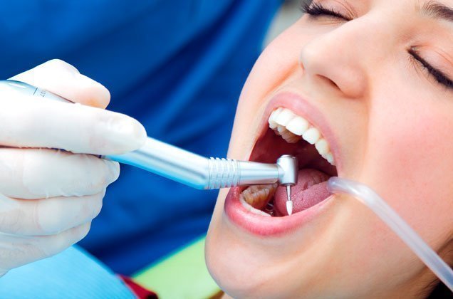 Qué tener en cuenta antes tratamiento dental